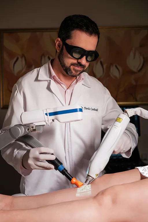 Aplicação de laser transdérmico sobre vasinhos na perna de uma paciente